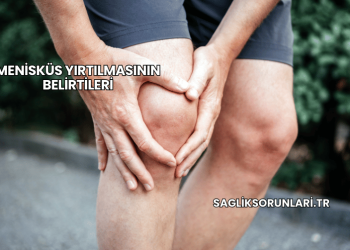 Menisküs Yırtılmasının Belirtileri