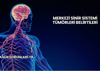 Merkezi Sinir Sistemi Tümörleri Belirtileri