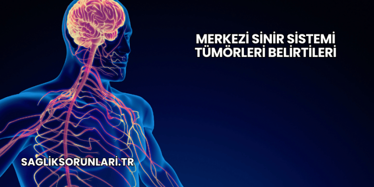 Merkezi Sinir Sistemi Tümörleri Belirtileri