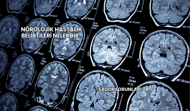 Nörolojik Hastalık Belirtileri Nelerdir?