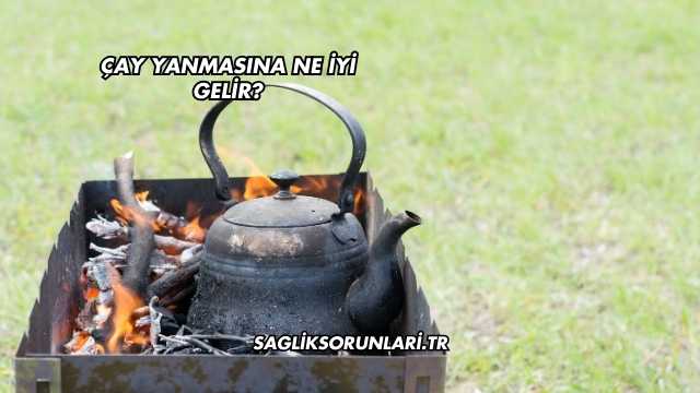 Çay Yanmasına Ne İyi Gelir?