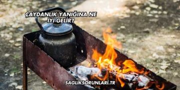 Çaydanlık Yanığına Ne İyi Gelir?