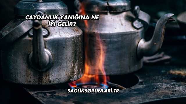 Çaydanlık Yanığına Ne İyi Gelir?