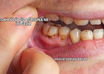 Çok Kötü Diş Ağrısına Ne İyi Gelir