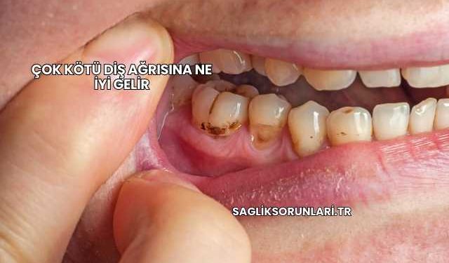 Çok Kötü Diş Ağrısına Ne İyi Gelir