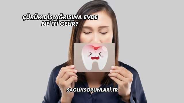 Çürük Diş Ağrısına Evde Ne İyi Gelir?