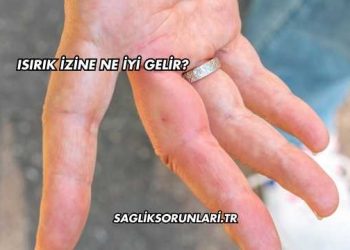 Isırık İzine Ne İyi Gelir?