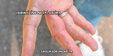 Isırık İzine Ne İyi Gelir?