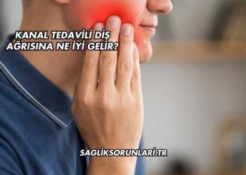 Kanal Tedavili Diş Ağrısına Ne İyi Gelir?