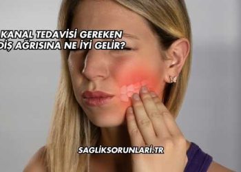 Kanal Tedavisi Gereken Diş Ağrısına Ne İyi Gelir?