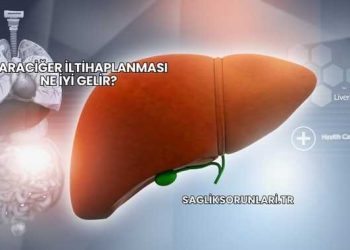 Karaciğer İltihaplanması Ne İyi Gelir?