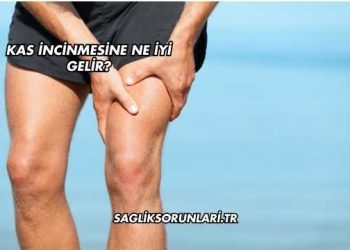 Kas İncinmesine Ne İyi Gelir?
