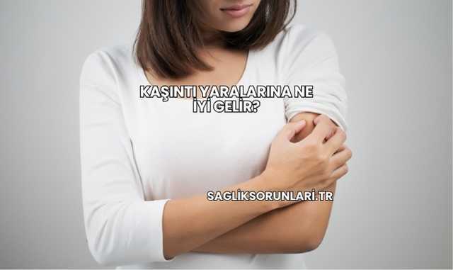 Kaşıntı Yaralarına Ne İyi Gelir?