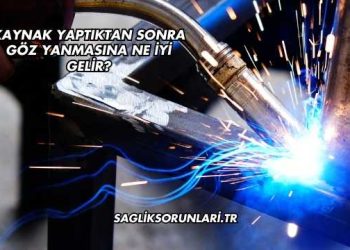 Kaynak Yaptıktan Sonra Göz Yanmasına Ne İyi Gelir?