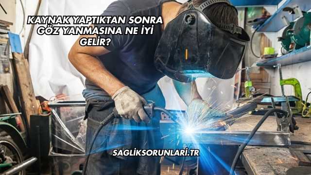 Kaynak Yaptıktan Sonra Göz Yanmasına Ne İyi Gelir?