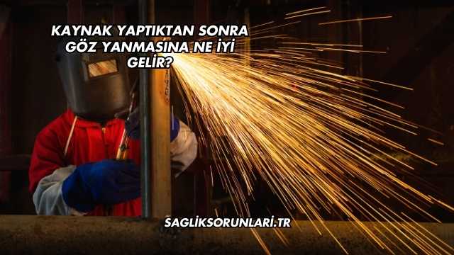 Kaynak Yaptıktan Sonra Göz Yanmasına Ne İyi Gelir?