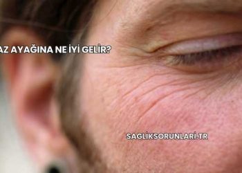 Kaz Ayağına Ne İyi Gelir?