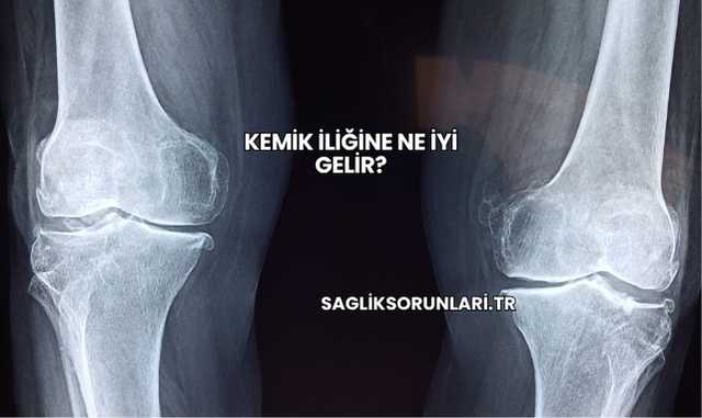 Kemik İliğine Ne İyi Gelir?