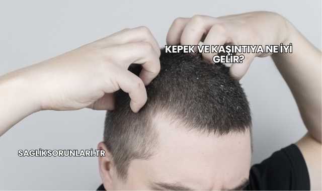 Kepek ve Kaşıntıya Ne İyi Gelir?