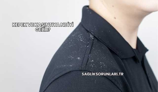 Kepek ve Kaşıntıya Ne İyi Gelir?