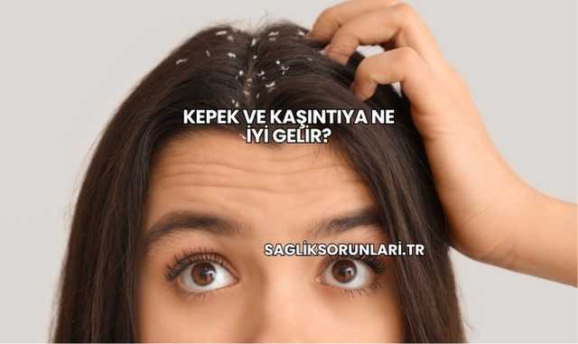 Kepek ve Kaşıntıya Ne İyi Gelir?