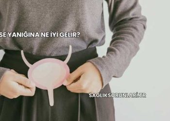 Kese Yanığına Ne İyi Gelir?