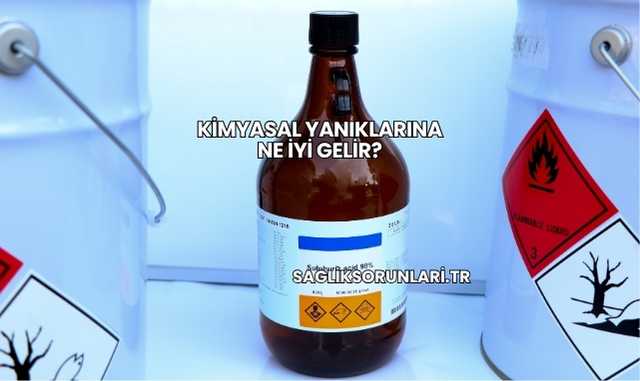Kimyasal Yanıklarına Ne İyi Gelir?