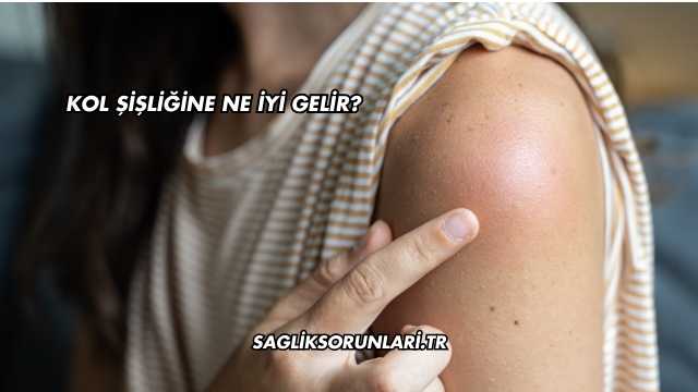 Kol Şişliğine Ne İyi Gelir?