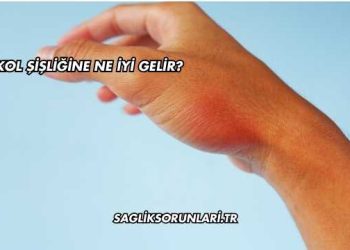 Kol Şişliğine Ne İyi Gelir?