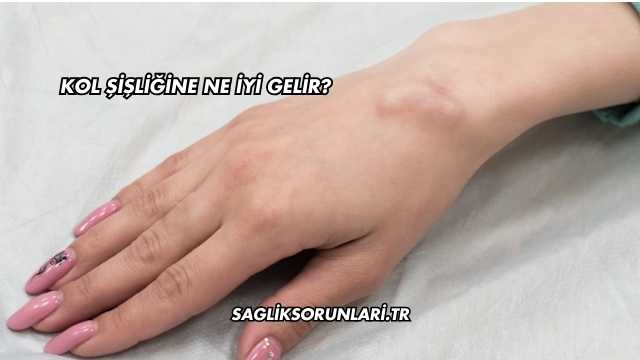 Kol Şişliğine Ne İyi Gelir?