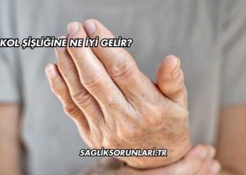 Kol Şişliğine Ne İyi Gelir?