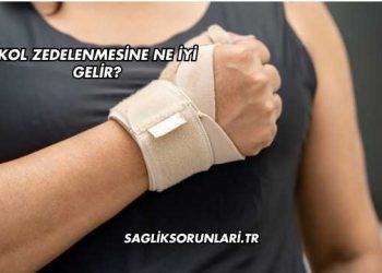 Kol Zedelenmesine Ne İyi Gelir?