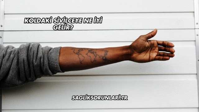 Koldaki Sivilceye Ne İyi Gelir?