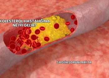 Kolesterol Hastalığına Ne İyi Gelir?