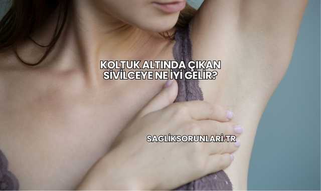 Koltuk Altında Çıkan Sivilceye Ne İyi Gelir?