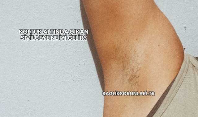Koltuk Altında Çıkan Sivilceye Ne İyi Gelir?