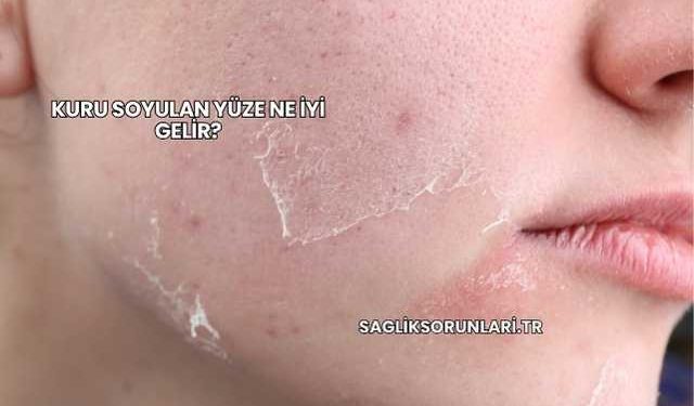 Kuru Soyulan Yüze Ne İyi Gelir?
