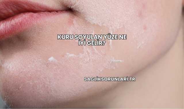 Kuru Soyulan Yüze Ne İyi Gelir?