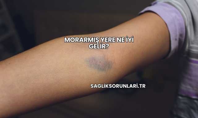 Morarmış Yere Ne İyi Gelir?