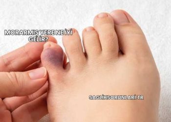 Morarmış Yere Ne İyi Gelir?