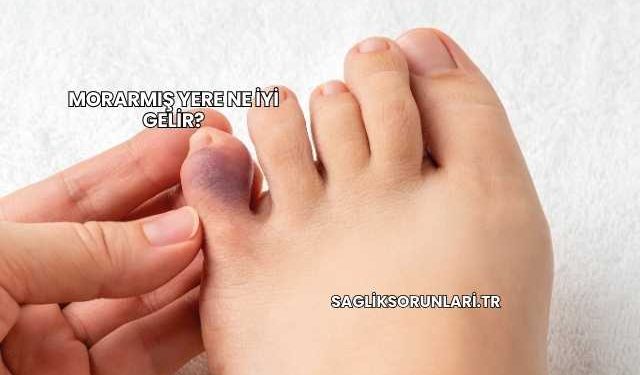 Morarmış Yere Ne İyi Gelir?