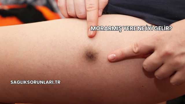 Morarmış Yere Ne İyi Gelir?