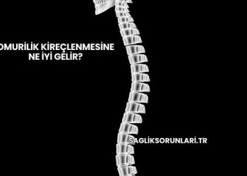 Omurilik Kireçlenmesine Ne İyi Gelir?