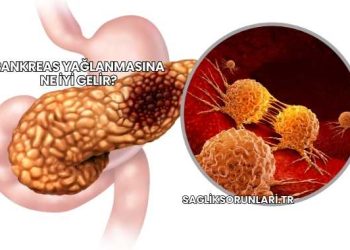 Pankreas Yağlanmasına Ne İyi Gelir?