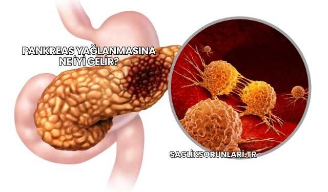 Pankreas Yağlanmasına Ne İyi Gelir?