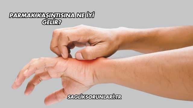 Parmak Kaşıntısına Ne İyi Gelir?