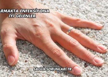 Parmakta Enfeksiyona İyi gelenler