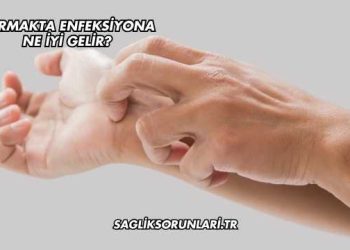 Parmakta Enfeksiyona Ne İyi Gelir?