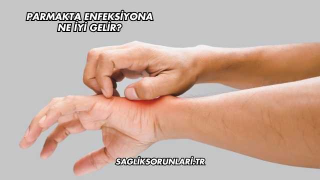 Parmakta Enfeksiyona Ne İyi Gelir?