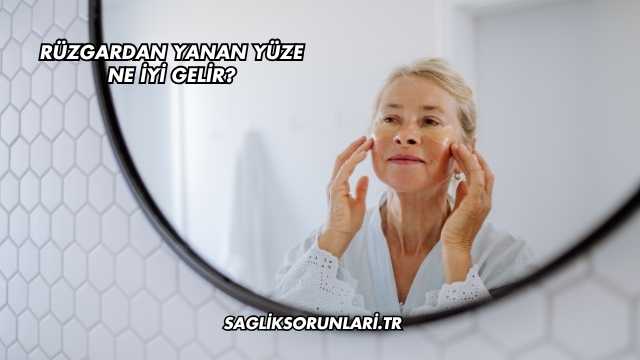 Rüzgardan Yanan Yüze Ne İyi Gelir?